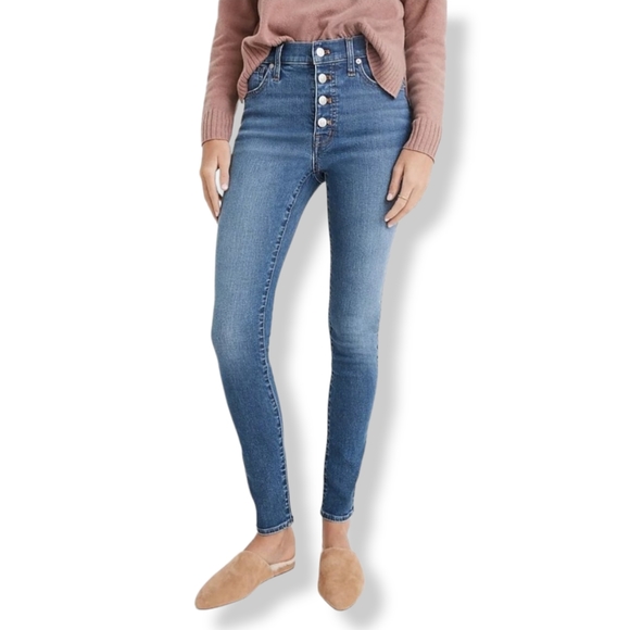 Madewell Denim - Madewell Button Fly 9" High Rise Skinny Jeans